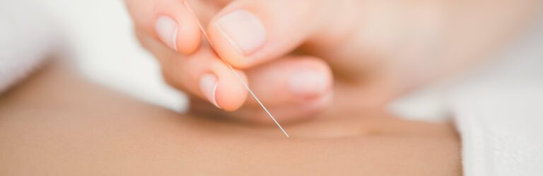 A close-up image of a hand inserting an acupuncture needle into a person's skin.