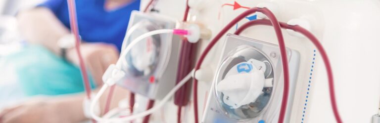 A close-up of dialysis machine components with tubes and dials visible, used for filtering blood in a medical setting. An out-of-focus medical professional is in the background.