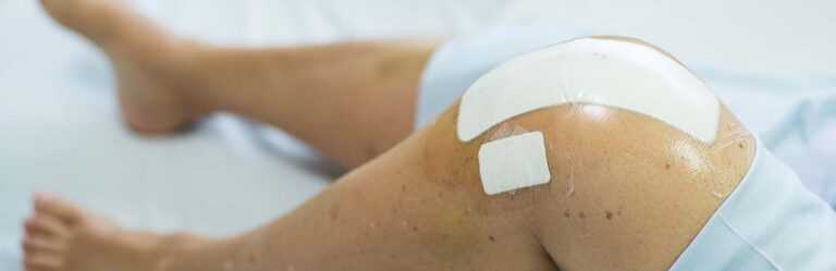 A close-up of a person's leg with a bandaged knee post-surgery, lying on a bed.