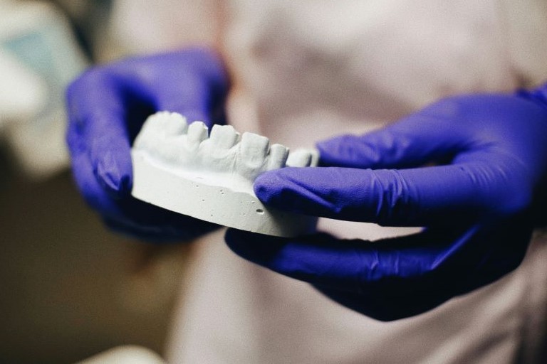 Glove-covered dentist hands holding a white mold of a patient's lower teeth.